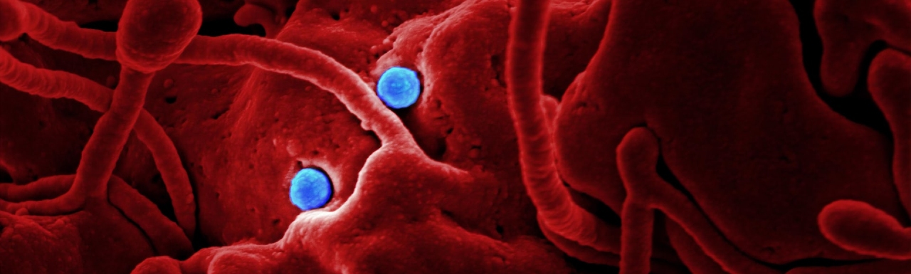Coronavirus graphic