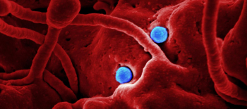 Coronavirus graphic