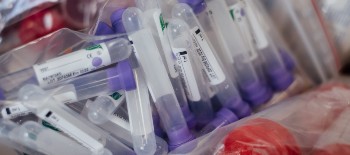 COVID samples piled up on one another COVID samples piled up on one another